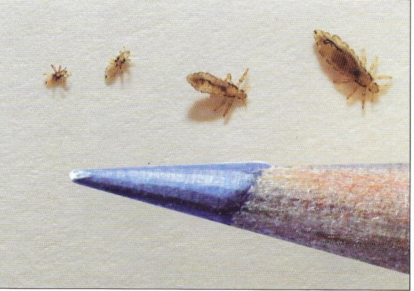 Guide to Identifying Lice & Nits | Signs, Eggs, and Treatment - Lice ...