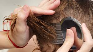 lice-clinics-treatment
