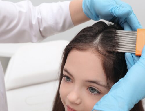 Lice Salon Treatments Seattle