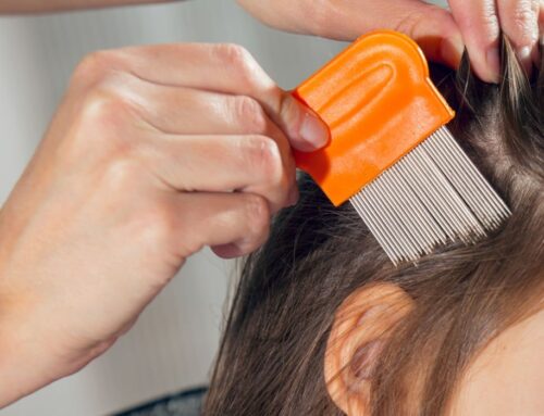 Lice Removal Seattle Metro