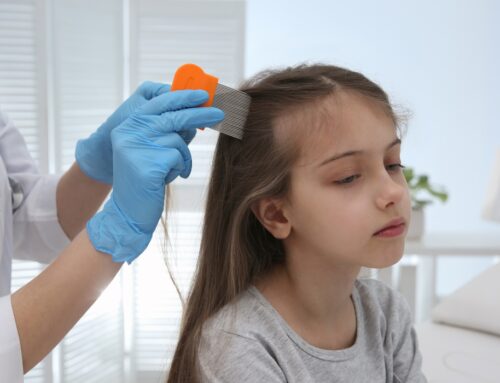 Same Day Lice Treatment Seattle – Urgent Lice Removal Service with Lice Charmers