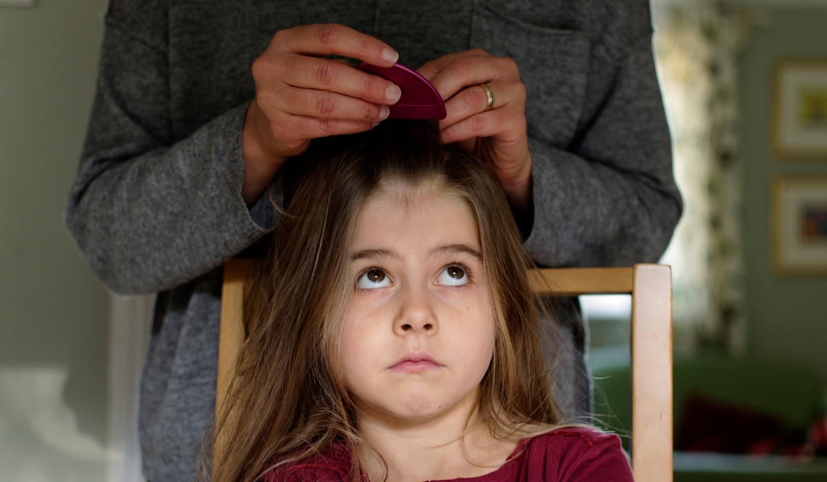 child with head lice treatment at home in Seattle