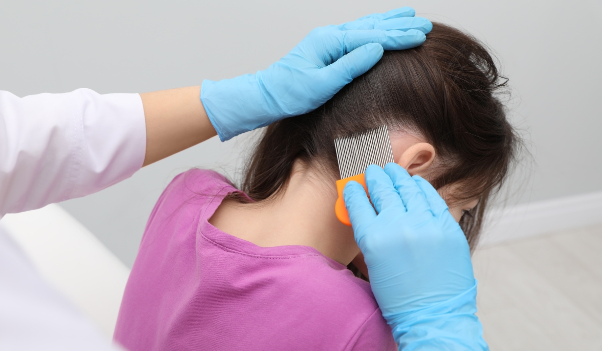 Seattle expert treats lice at home