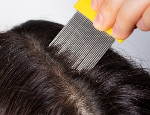 Lice Inspection Services Seattle